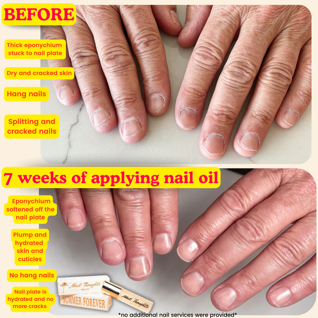 Nail Thoughts Summer Forever Nail Oil 10ml - Image 2